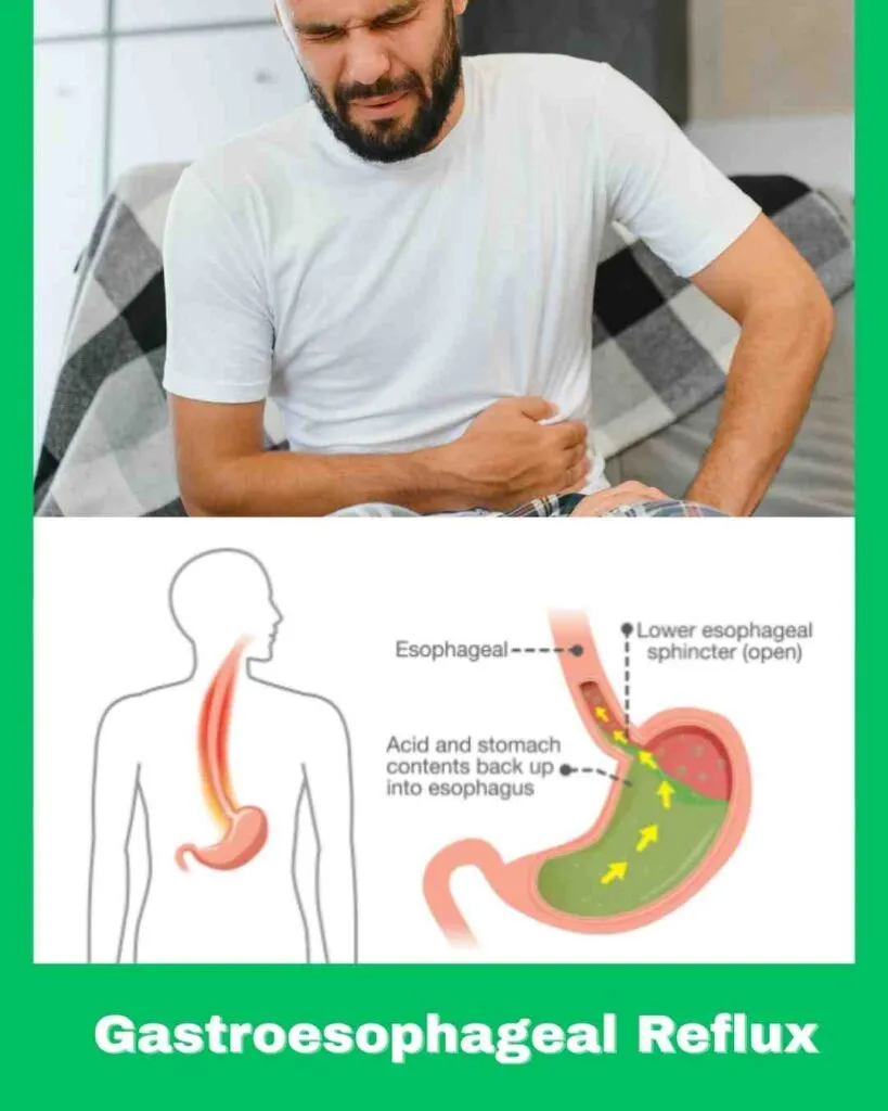 are bananas acidic for stomach